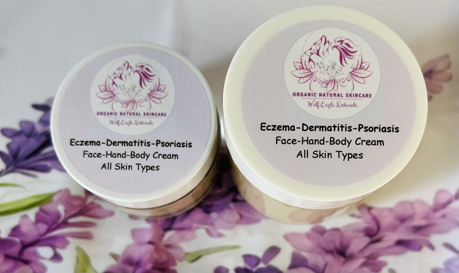 Eczema, Atopic-Dermatitis, Psoriasis Gentle Cream