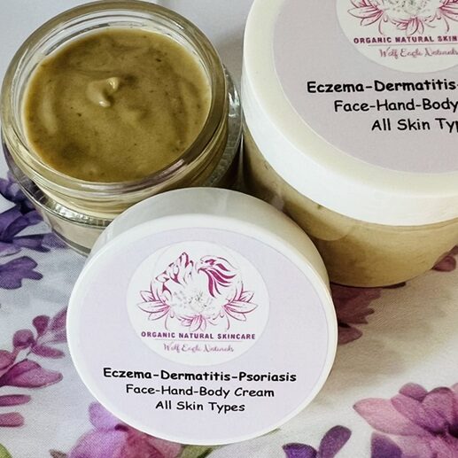 Eczema, Dermatitis <br>Cream Eczema, Atopic-Dermatitis, Psoriasis Gentle Cream