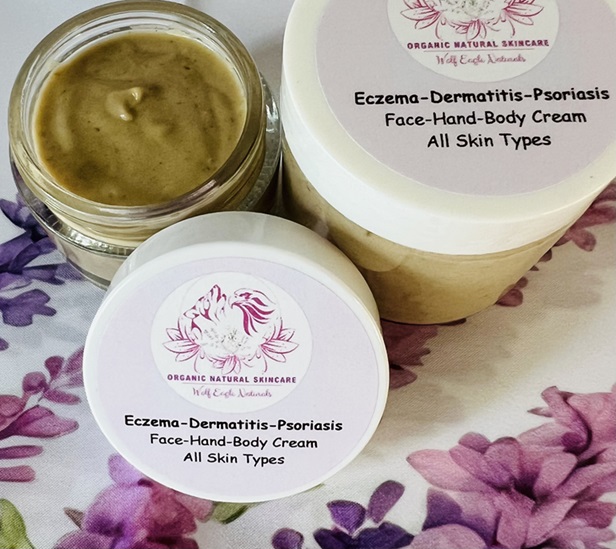 Eczema, Atopic-Dermatitis, Psoriasis Gentle Cream