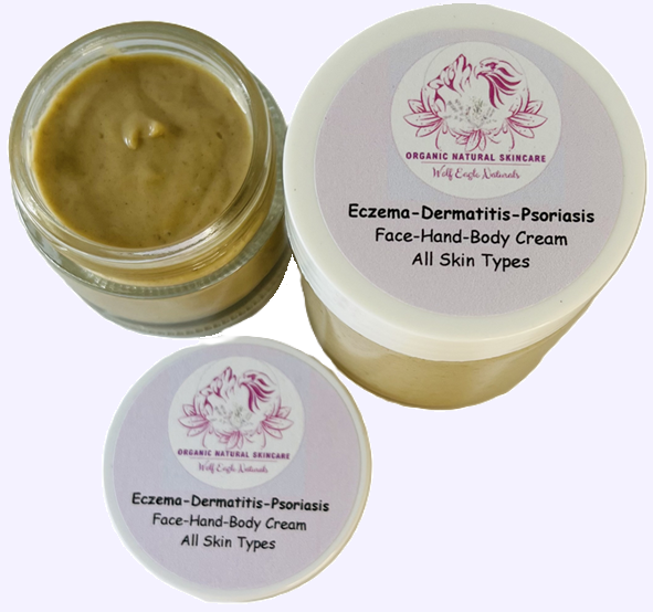 Eczema, Atopic-Dermatitis, Psoriasis Gentle Cream